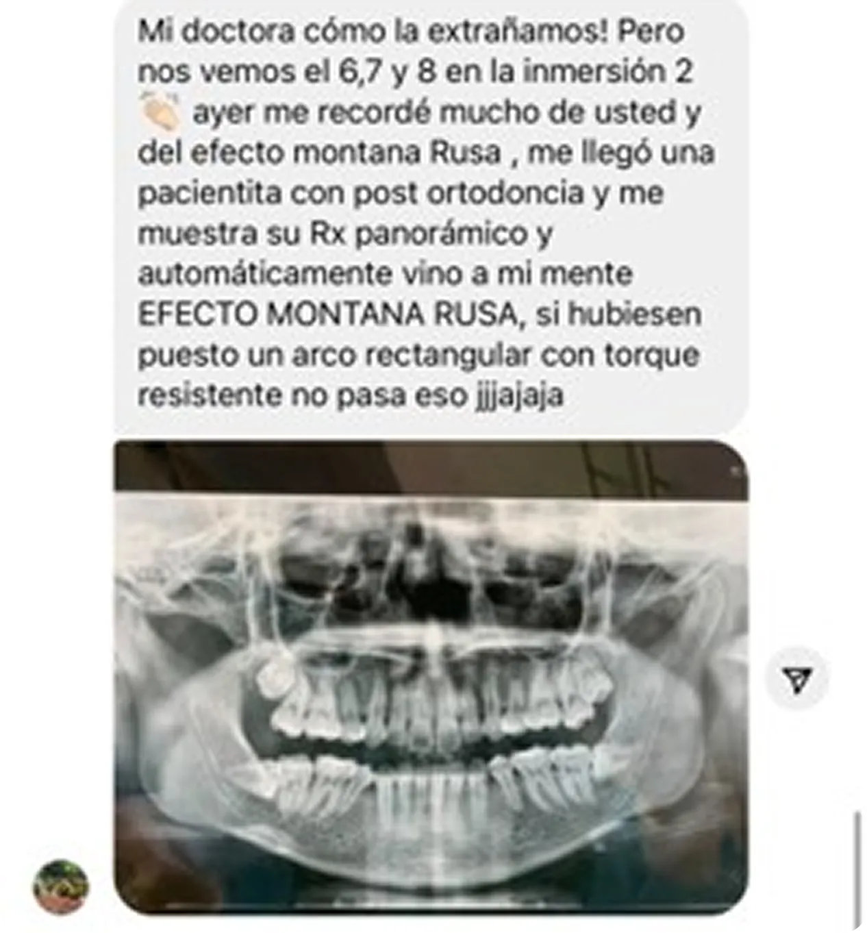 Mensaje de una alumna sobre el efecto montaña rusa
